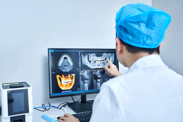 Best Emergency Root Canal Treatment in Colesville, MD