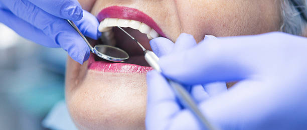 Best Weekend Emergency Dentist in Colesville, MD